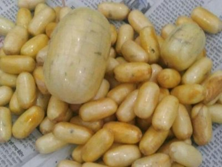 Հնդկաստանում կնոջ օրգանիզմից կոկաինով 106 կապսուլա են հանել