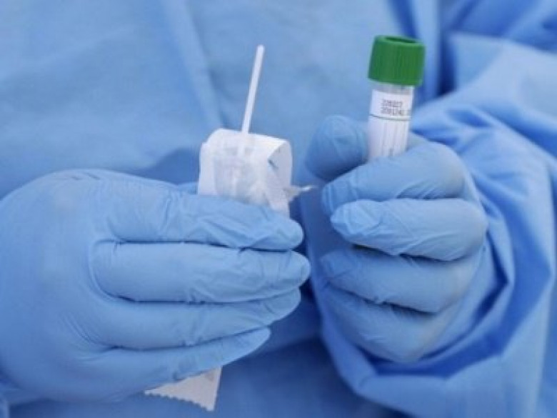 Հունաստանում կբաժանեն կորոնավիրուսի թեստավորման համար անվճար հավաքածուներ